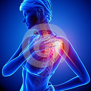 Female shoulder pain