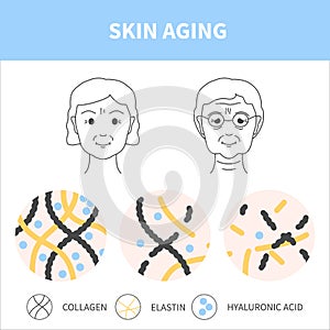 Female skin aging and collagen loss diagram illustration