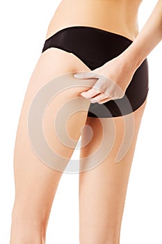 Female squeezes cellulite skin on her legs. Close-up shot on white background.