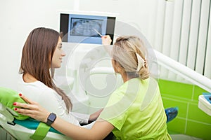 Female stomatologist in protective gloves examining patient`s teeth. Dentist caries treatment at dental clinic office