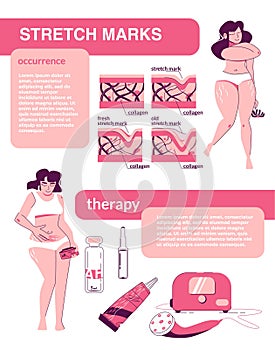 Female Stretch Marks Infographics