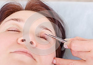 Surgeon applies a bandage to the female patient`s eyelids after