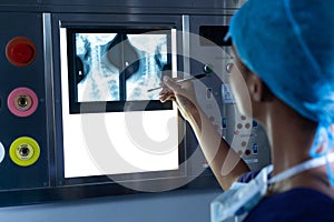 Female surgeon examining x-ray on a light box in the hospital