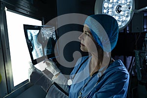 Female surgeon examining x-ray on light box in operating room at hospital