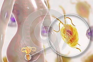 Female trichomoniasis, illustration showing Trichomonas vaginalis parasite photo