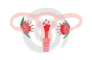 Female uterus with menstrual blood inside and flowers. Womb organ during menstruation. Women reproductive system and photo