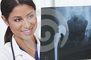 Female Woman Hospital Doctor with X-Ray