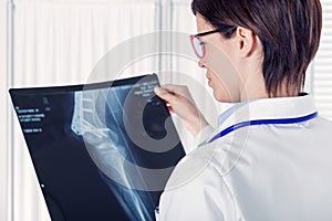 Female young doctor or radiologist with an x-ray