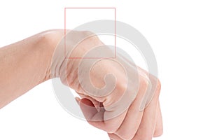 Females hand with big cyst hygroma circled in red square isolated on white