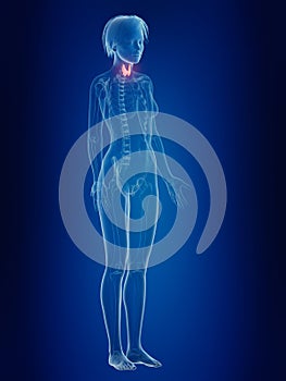 A females inflamed thyroid gland