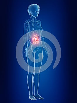 a females painful intestine