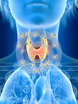 A females thyroid gland being attacked by antibodies