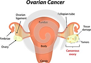 Fertilisation in the Uterus