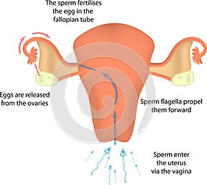Fertilisation in the Uterus