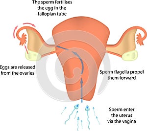 Fertilisation in the Uterus photo