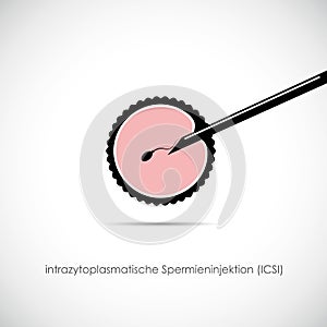 Fertility reproduction of ovum and spermatozoon ICSI