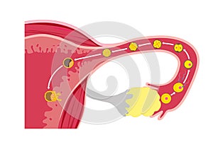 Fertilization and implantation