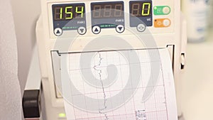 Fetal heartbeat monitor, cardiotocography