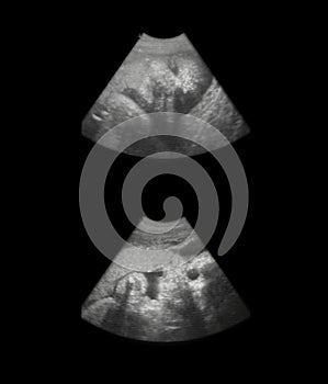 Fetus sonogram - 8 month photo