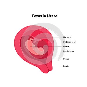 Fetus in utero gynecology infographic diagram. Vector flat healthcare illustration. Embryo in womb with text isolated on white