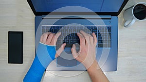 Fiberglass blue cast hand laptop program code