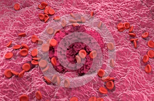 Red cells and fibrin coagulum - isometric view 3d illustration photo