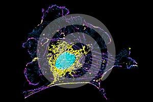 Fibroblast cell