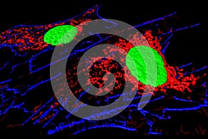 Fibroblast cells photo