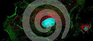 Fibroblast cells: big and small