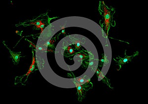 Fibroblast cells in culture