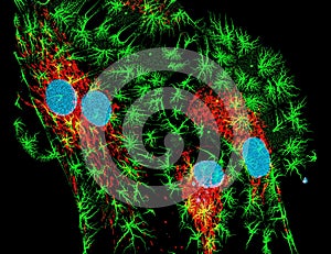 Fibroblasts photo