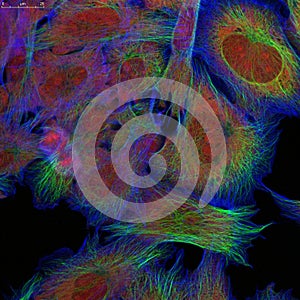 Fibroblasts (skin cells) labeled with fluorescence dyes