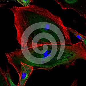 Fibroblasts (skin cells) labeled with fluorescence dyes