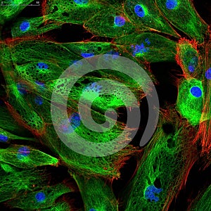 Fibroblasts (skin cells) labeled with fluorescent photo