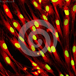 Fibroblasts (skin cells) labeled with fluorescent dyes photo