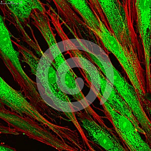 Fibroblasts (skin cells) labeled with fluorescent dyes photo