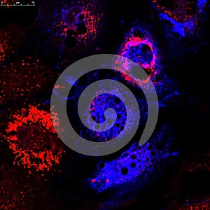 Fibroblasts (skin cells) labeled with fluorescent dyes photo