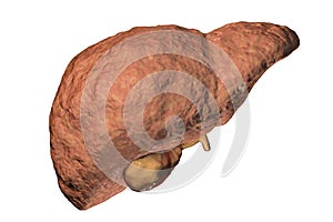 Fibrotic liver illustration