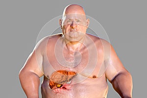 Fibrotic liver in obese man, 3D illustration