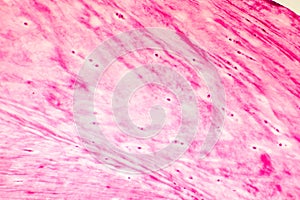 Fibrous cartilage, light micrograph photo