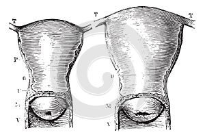 Fig. 1229. Uterus virgin women, seen by its anterior aspect, Fig