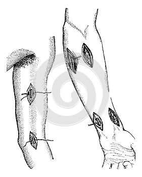 Fig. 760. - Showing the different points at which the arm can be