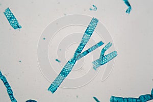 Spirogyra alga under the microscope