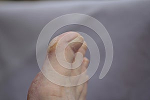 With the file on the toe