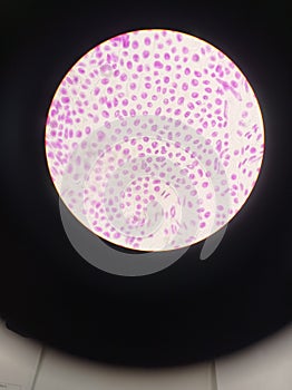 Fillament of a cianobacteria with a microscope. Cells un mitosis photo