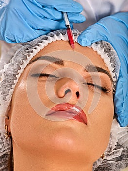 Filler injection for forehead face. Plastic aesthetic facial surgery.