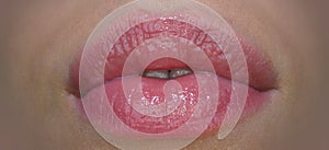 Filler injections, tender lips. Sensual female mouth. Close up glossy luxury mouth, glamour lip concept.