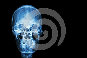 Film x-ray skull of human and blank area at right side ( Medical , Science and Healthcare concept and background )