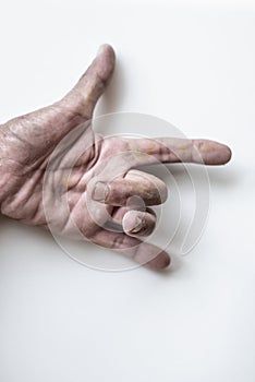 The finger of an elderly person who is sick, the trigger lock finger