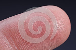 Finger with friction ridges on dark background, macro view